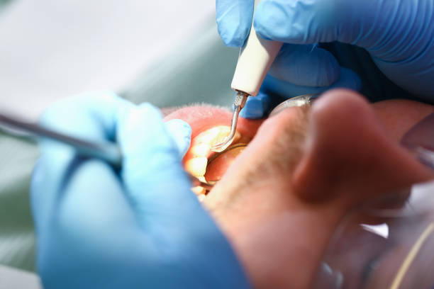 Best Emergency Dental Care for Abscessed Tooth in Olivet, MI