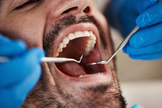 Best Orthodontic Emergency Dentist in Olivet, MI