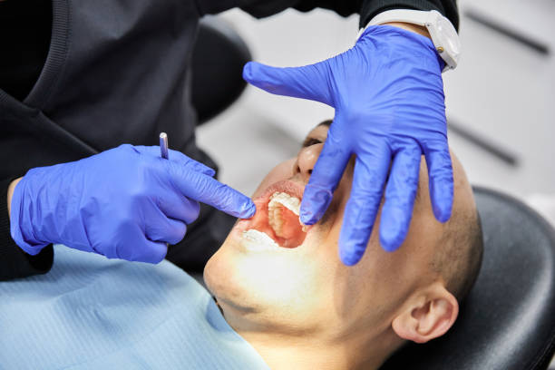 Best Emergency Root Canal Treatment in Olivet, MI